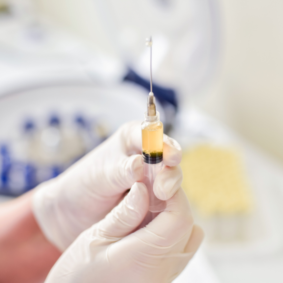 Osocze bogatopłytkowe w laryngologii