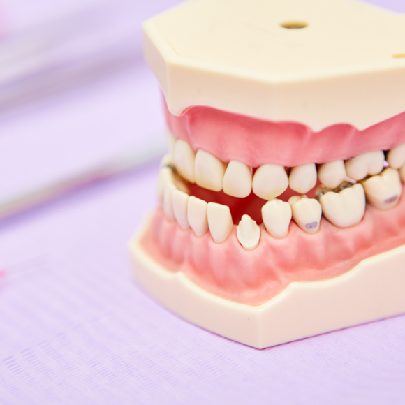 Problemy laryngologiczne a wady zgryzu