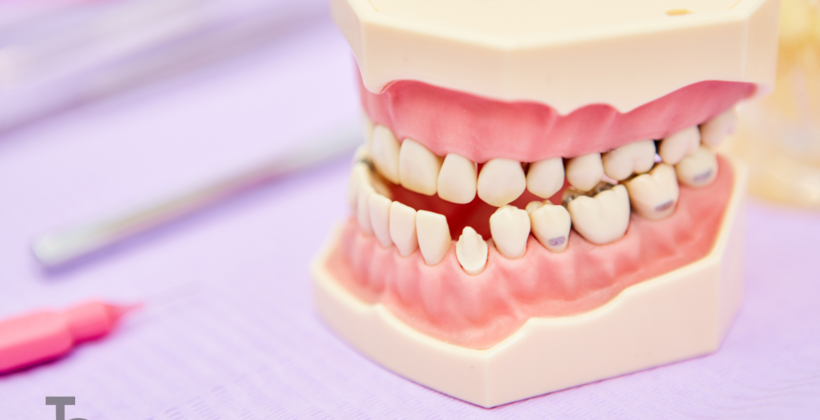 Problemy laryngologiczne a wady zgryzu